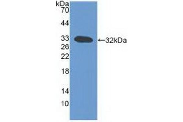 LTB antibody  (AA 58-304)