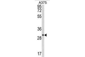 Western blot analysis of CTHRC1 Antibody (N-term) in A375 cell line lysates (35ug/lane).