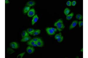 Immunofluorescence staining of A549 cells with ABIN7153289 at 1:100, counter-stained with DAPI. (KCNJ5 antibody  (AA 348-419))