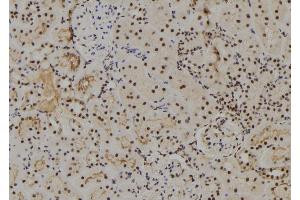 ABIN6273801 at 1/100 staining Rat kidney tissue by IHC-P. (NUAK2 antibody  (Internal Region))