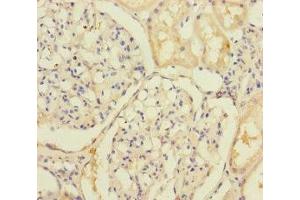 Immunohistochemistry of paraffin-embedded human kidney tissue using ABIN7176692 at dilution of 1:100 (SLC39A7 antibody  (AA 235-380))