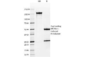 SDS-PAGE (SDS) image for anti-Mucin 1 (MUC1) antibody (ABIN6940096)