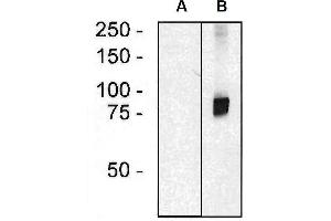 Western blotting analysis of ARHGEF4 in HEK293 cells (A) and HEK293-ARHGEF4 transfectants (B) using mouse monoclonal anti-ARHGEF4 (clone ARHGEF-08). (ARHGEF4 antibody  (AA 143-271) (PE))