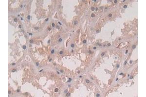 IHC-P analysis of Human Kidney Tissue, with DAB staining. (IL-5 antibody  (AA 20-134))