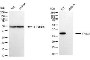 Western blotting analysis using TREX1 antibody (ABIN7800547).