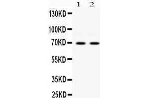 Observed bind size: 69KD (EIF2AK2 antibody  (C-Term))