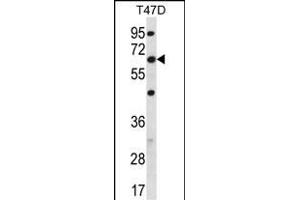 FD Antibody (C-term) (ABIN656450 and ABIN2845735) western blot analysis in T47D cell line lysates (35 μg/lane).