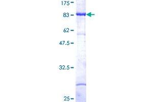 MAP3K8 Protein (AA 1-467) (GST tag)