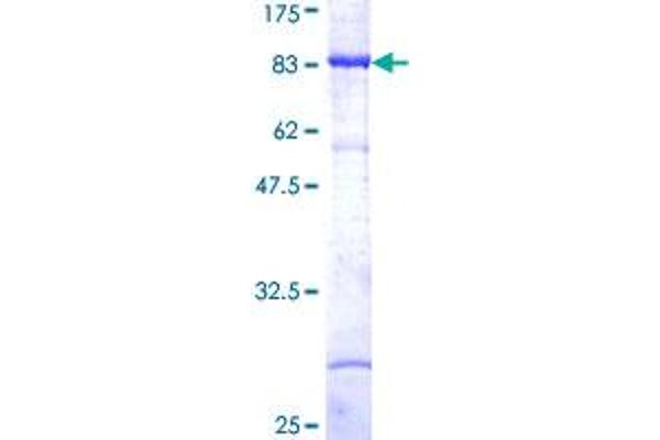 MAP3K8 Protein (AA 1-467) (GST tag)