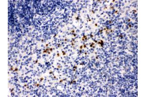 Anti- MMP8 Picoband antibody,IHC(P) IHC(P): Mouse Spleen Tissue (MMP8 antibody  (N-Term))