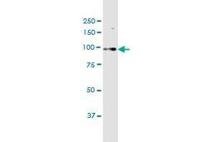 C15orf55 monoclonal antibody (M03), clone 8B1. (NUT (AA 1033-1132) antibody)