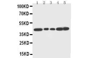 Anti-Decorin antibody, Western blotting Lane 1: Rat Liver Tissue Lysate Lane 2: Rat Lung Tissue Lysate Lane 3: Rat Spleen Tissue Lysate Lane 4: SMMC Cell Lysate Lane 5: SMMC Cell Lysate (Decorin antibody  (C-Term))