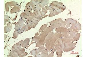 Immunohistochemistry (IHC) analysis of paraffin-embedded Human Muscle, antibody was diluted at 1:100. (SDHB antibody  (Internal Region))