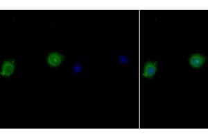 Detection of IL10Ra in Human MCF7 cell using Polyclonal Antibody to Interleukin 10 Receptor Alpha (IL10Ra) (IL-10RA antibody  (AA 132-235))
