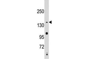 Western blot analysis of SMC2 antibody and Jurkat lysate. (SMC2 antibody  (AA 1166-1197))