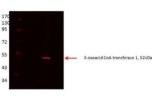 OXCT1 antibody - middle region  validated by WB using Proximal kidney tubules purfied from cortex at 1:1000. (OXCT1 antibody  (Middle Region))