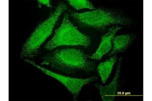Immunofluorescence of monoclonal antibody to GCH1 on HeLa cell. (GCH1 antibody  (AA 1-250))