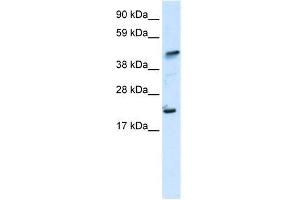 Human muscle; WB Suggested Anti-ZNFN1A5 Antibody Titration: 0. (IKZF5 antibody  (N-Term))