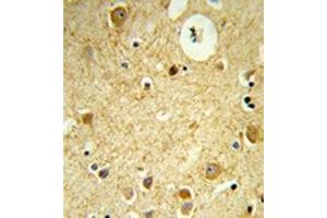 Formalin-fixed and paraffin-embedded human brain tissue reacted with RECK / ST15  Antibody  which was peroxidase-conjugated to the secondary antibody, followed by DAB staining.