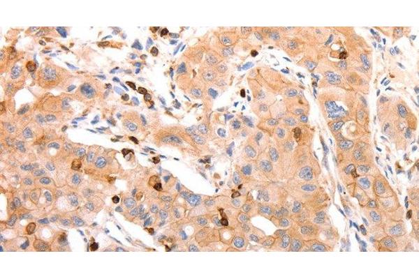 CELSR2 antibody