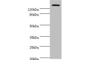 Western blot All lanes: TP53BP2 antibody at 2 μg/mL + Mouse thymus Secondary Goat polyclonal to rabbit IgG at 1/10000 dilution Predicted band size: 126, 112, 127 kDa Observed band size: 126 kDa (TP53BP2 antibody  (AA 360-600))