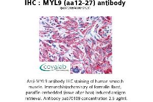Image no. 1 for anti-Myosin Regulatory Light Chain 2, Smooth Muscle Isoform (MYL9) (AA 12-27) antibody (ABIN1737166) (MYL9 antibody  (AA 12-27))