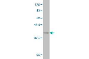 Western Blot detection against Immunogen (36. (SOD3 antibody  (AA 26-125))