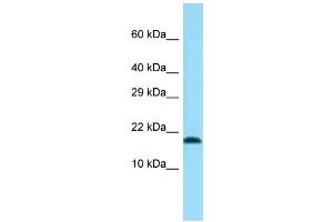 Western Blotting (WB) image for anti-Transmembrane Protein 50B (TM50B) (N-Term) antibody (ABIN2774278) (TMEM50B antibody  (N-Term))