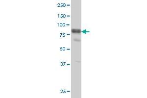 DVL3 monoclonal antibody (M04), clone 4H2 Western Blot analysis of DVL3 expression in A-431 . (DVL3 antibody  (AA 1-100))