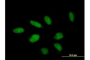 Immunofluorescence of purified MaxPab antibody to TTC23 on HeLa cell. (TTC23 antibody  (AA 1-393))