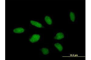 Immunofluorescence of purified MaxPab antibody to TTC23 on HeLa cell.