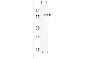 Western blot analysis of PIP5K1A (arrow) using rabbit polyclonal hPIP5K1A-R34 (ABIN392593 and ABIN2842123). (PIP5K1A antibody  (N-Term))