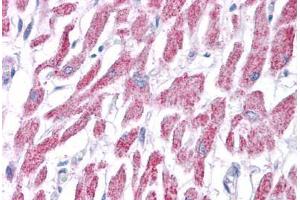 Human Heart: Formalin-Fixed, Paraffin-Embedded (FFPE) (ACAT1 antibody  (AA 218-267))
