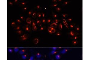Immunofluorescence analysis of 293T cells using AARS Polyclonal Antibody at dilution of 1:100 (40x lens). (AARS antibody)