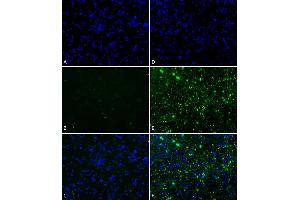 Primary rat hippocampal neurons show lewy body inclusion formation when treated with Type 1 Alpha Synuclein Pre-formed Fibrils (ABIN5065824) at 4 μg/mL (D-F), but not when treated with Type 2 Alpha Synuclein Pre-formed Fibrils (ABIN5065824) at 4 μg/mL (A-C). (SNCA Protein (full length))