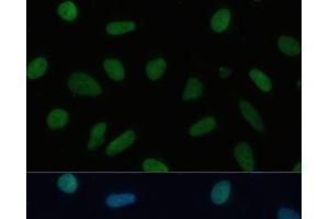 Immunofluorescence analysis of U-2 OS cells using TRIM28 Polyclonal Antibody at dilution of 1:100 (40x lens). (KAP1 antibody)