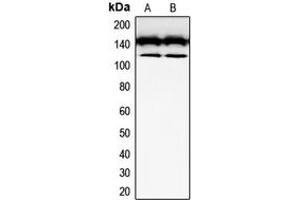 Western blot analysis of CD117 expression in SKNSH (A), Jurkat (B) whole cell lysates. (KIT antibody  (Center))