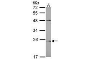 Image no. 1 for anti-Chromosome 1 Open Reading Frame 146 (C1ORF146) (AA 1-180) antibody (ABIN1497028) (C1ORF146 antibody  (AA 1-180))