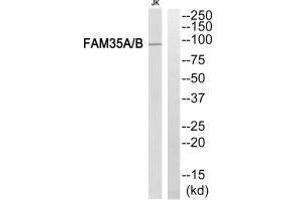 Western blot analysis of extracts from Jurkat cells, using FAM35A/B antibody. (FAM35A antibody)