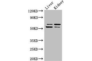 Western Blot Positive WB detected in: Mouse liver tissue, Mouse kidney tissue All lanes: LMBRD1 antibody at 4 μg/mL Secondary Goat polyclonal to rabbit IgG at 1/50000 dilution Predicted band size: 62, 45, 54, 22 kDa Observed band size: 62, 54 kDa (LMBRD1 antibody  (AA 6-100))