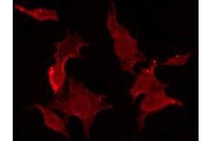 ABIN6275949 staining COLO205 by IF/ICC. (GPR176 antibody  (C-Term))
