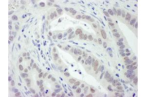 Immunohistochemistry (IHC) image for anti-Replication Protein A2, 32kDa (RPA2) (AA 220-270) antibody (ABIN7454567)