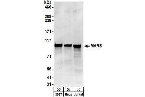 Western Blotting (WB) image for anti-Mars (MARS) (AA 175-225) antibody (ABIN7454993)