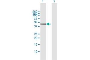 Western Blot analysis of MVD expression in transfected 293T cell line by MVD MaxPab polyclonal antibody. (MVD antibody  (AA 1-400))