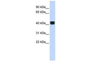 TRIOBP anticorps  (AA 144-193)