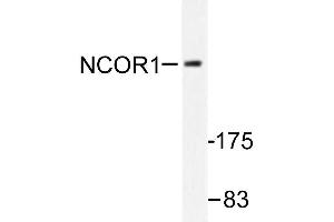 Image no. 1 for anti-Nuclear Receptor Co-Repressor 1 (NCOR1) antibody (ABIN271948)