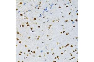 Immunohistochemistry of paraffin-embedded mouse spinal cord using SNRNP70 antibody. (SNRNP70 antibody  (AA 150-250))