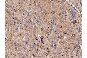 IHC analysis of GPR54/KISS1R using anti-GPR54/KISS1R antibody (ABIN7602153). (KISS1R antibody  (AA 60-373))