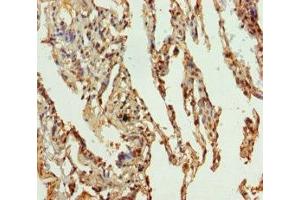 Immunohistochemistry of paraffin-embedded human lung tissue using ABIN7169989 at dilution of 1:100 (Solute Carrier Family 34 (Type II Sodium/phosphate Contransporter), Member 1 (SLC34A1) (AA 1-103) antibody)