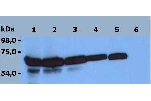 Western Blotting analysis (reducing conditions) of HPB-ALL peripheral blood T cell leukemia cell line. (ZAP70 antibody  (C-Term))